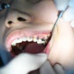 Zdrowie jamy ustnej - dentysta Żoliborz