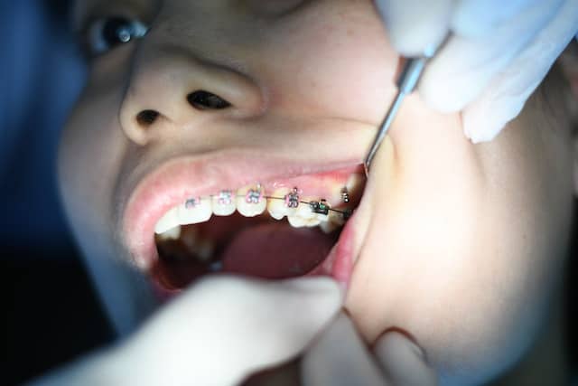 Zdrowie jamy ustnej – dentysta Żoliborz